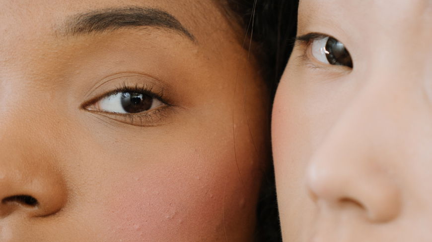 Unreine Haut: Auf DIESE Gesichtscreme schwören gerade alle Beauty-Fans