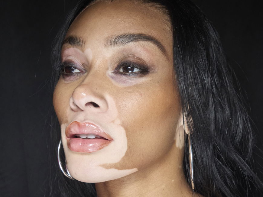 Winnie Harlow mit perfekten Augenbrauen