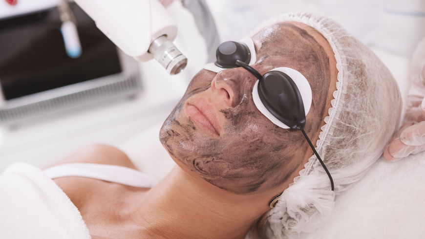 Carbon Peeling: Das solltest du vor der Behandlung wissen