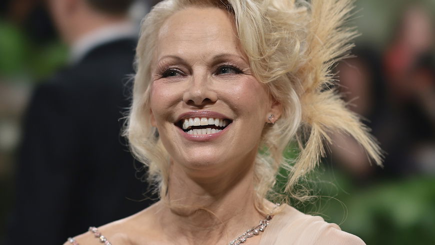 Pamela Anderson: Warum ihre Beauty-Metamorphose so dringend nötig ist