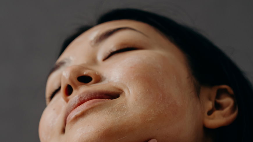 Sonnencreme bei Akne: So schützt du deine Haut optimal