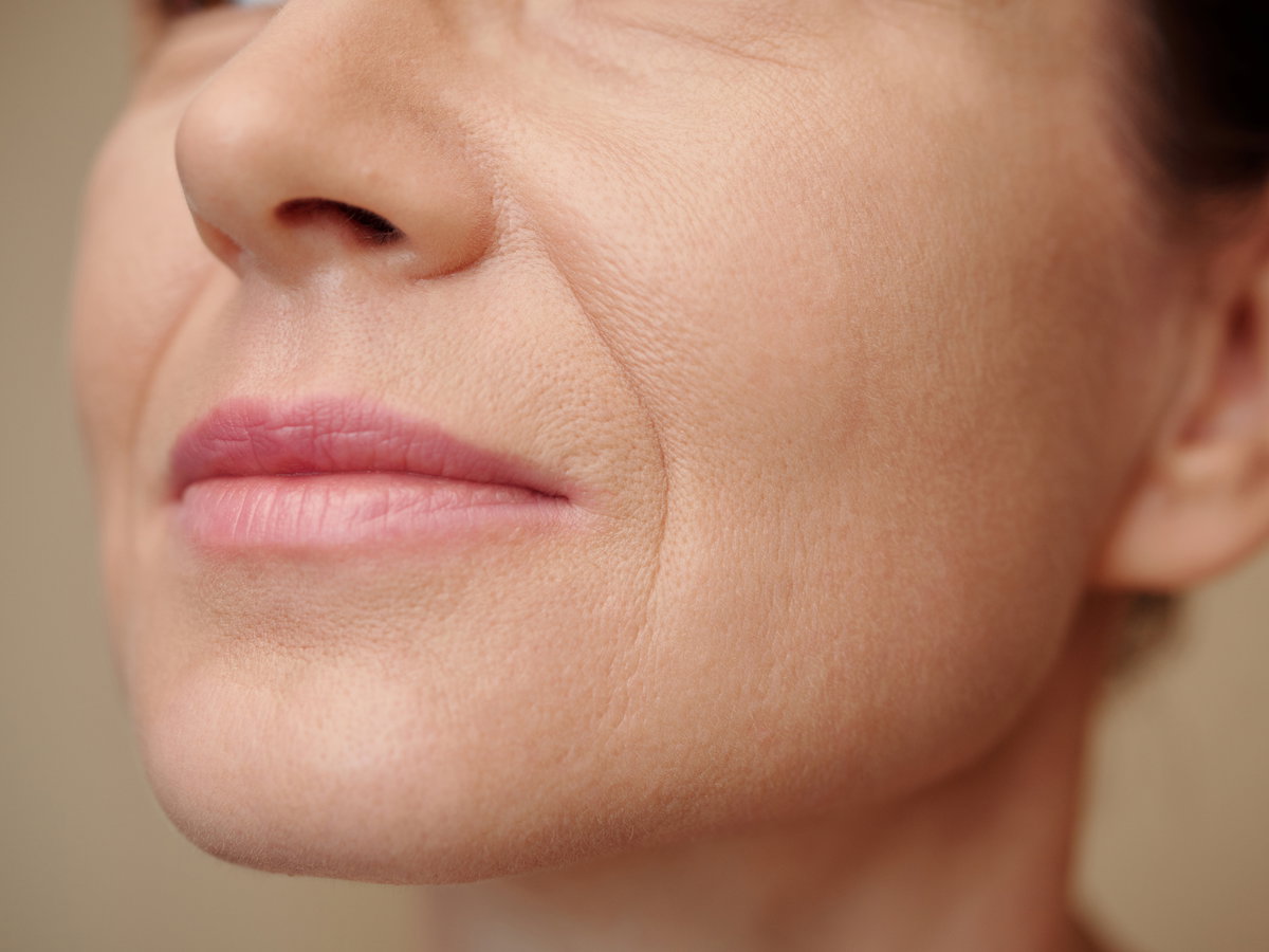 Frau mit Lippenfalten
