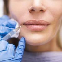 Lippen aufspritzen: Ärztin verrät 5 Dinge, die du wissen solltest