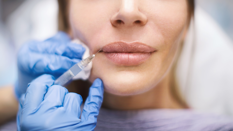 Lippen aufspritzen: Ärztin verrät 5 Dinge, die du wissen solltest