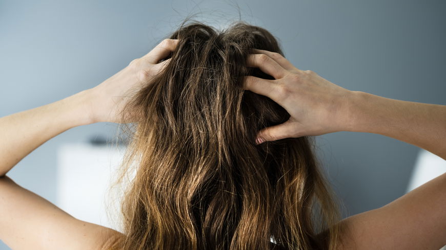 Gegen Schuppen und Fett: Dieser Trick rettet deine Kopfhaut im Nu