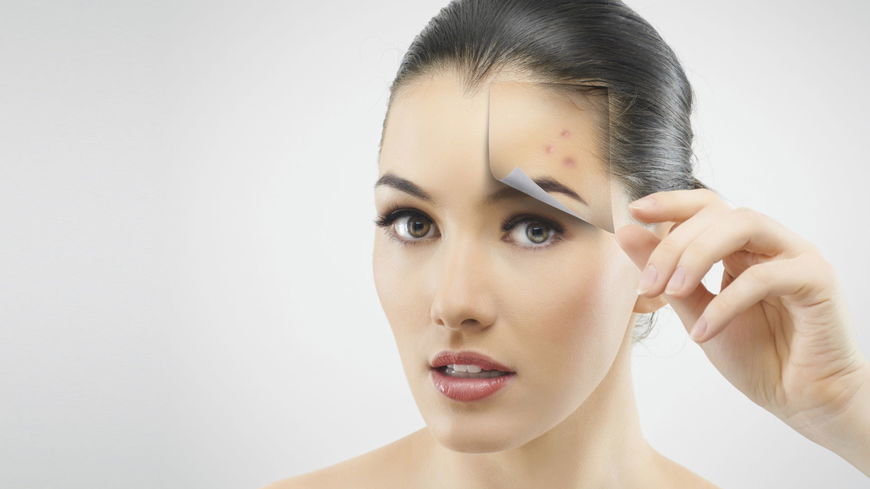 Tipps: Narben verstecken