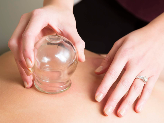 Face Cupping: Das neue Wundermittel gegen Falten