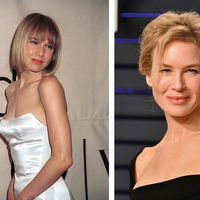Vorher & Nachher: So verändert sehen die Stars durch ihre Schönheits-OPs aus