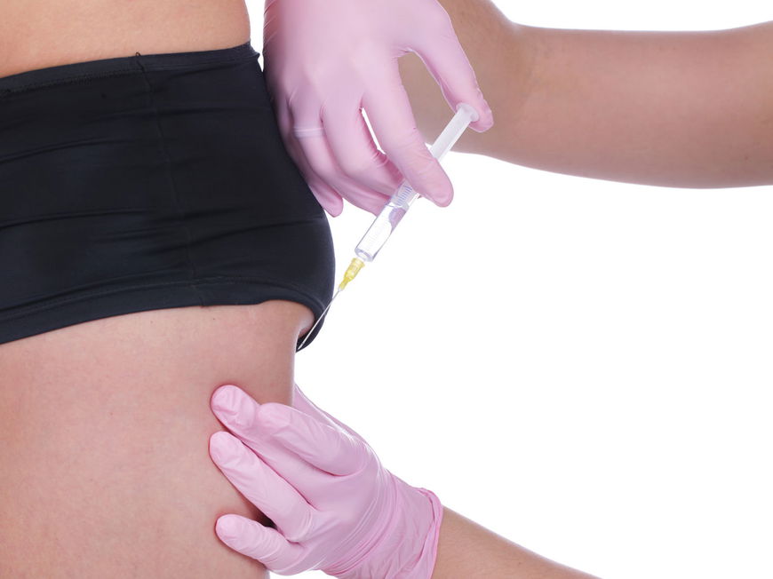 Fett-weg-Spritze – wieso, weshalb, warum? 10 Fragen und Antworten